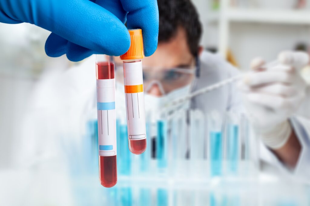 Scientists Create First Accurate Blood Test for Chronic Fatigue Syndrome
