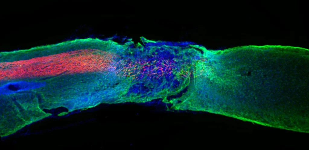 Spinal Cord Repair Cells Found